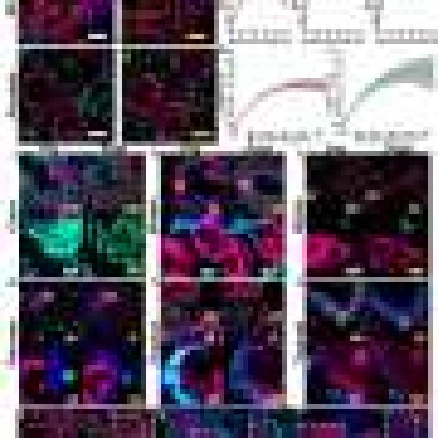 New expansion microscopy methods magnify research’s impact