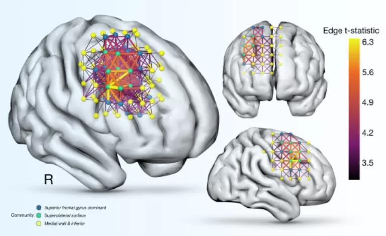 Neuroscientists Identify Brain Regions Necessary for Fluid Intelligence