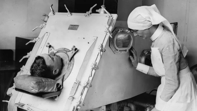Polio survivors in the US still struggle with the aftershocks of the disease decades later
