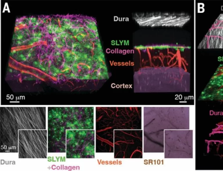 A mesothelium divides the subarachnoid space into functional compartments | Science
