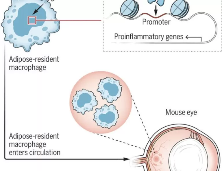 Obesity confers macrophage memory | Science