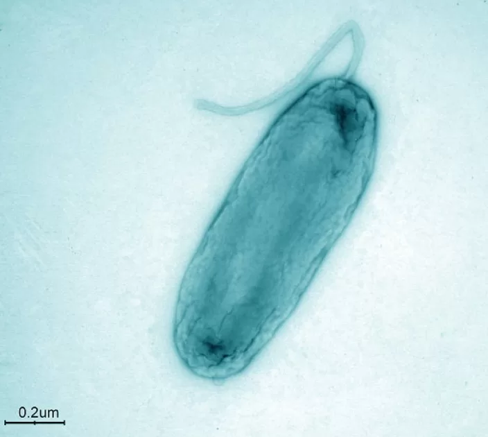 New Legionella Species Discovered in Italy
