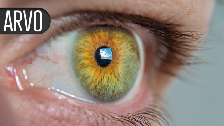 VEGF Inhibitor Implant Preserves Visual Acuity, Retinal Anatomy in Wet AMD